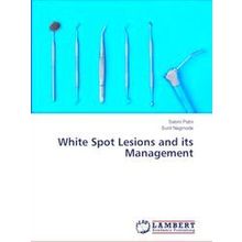 White Spot Lesions and its Management