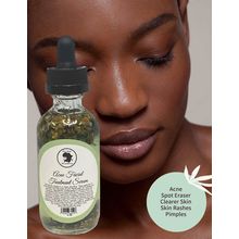 Acne Facial Serum[ ]