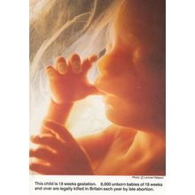 Anti Abortion Legal Age 1980s Protest Postcard