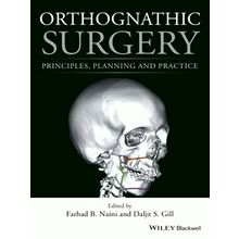 Orthognathic Surgery - Principles, Planning and Practice - Farhad B. Naini