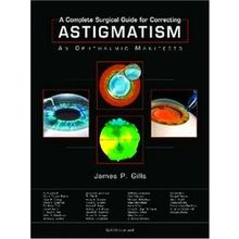 A Complete Surgical Guide for Correcting Astigmatism