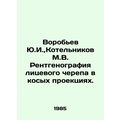 Yu.I. Vorobyov, M.V. Kotelnikov X-ray of the fa...