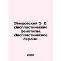Zemtsovsky E.V. Displastic phenotypes. Displast...