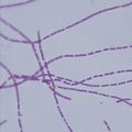 Bacterial Pathogens Microscope Slide Set, Refer...
