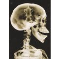 Skeleton Football FA Cup In Brain Building Soci...