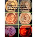 3D Ultrasound in Prenatal Diagnosis