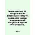 Kalashnikova L., Dobrynina L. Brain artery dissection: ischemic stroke and oth