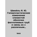 Schmeil A. Yu. Hyperplastic changes in the lining of the fallopian tubes and the
