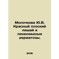 Yu.V. Molochkovas Red Flat Lichenoid and Lychen...