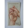 1913 Wills First Aid No. 44 Bite of Animal (wit...