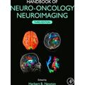 Handbook of Neuro-Oncology Neuroimaging
