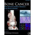 Bone Cancer