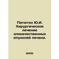 Patyutko Yu.I. Surgical treatment of malignant ...