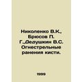 Nikolenko V.K., Bryusov P. G., Granduskin V.S. Shotgun wounds to the hand. In