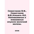 Semiglazov V.F., Semiglazov V.V., Kletsel A.E. Non-invasive and invasive brea